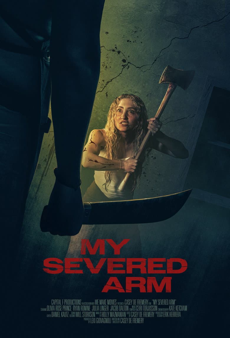 My Severed Arm Banner